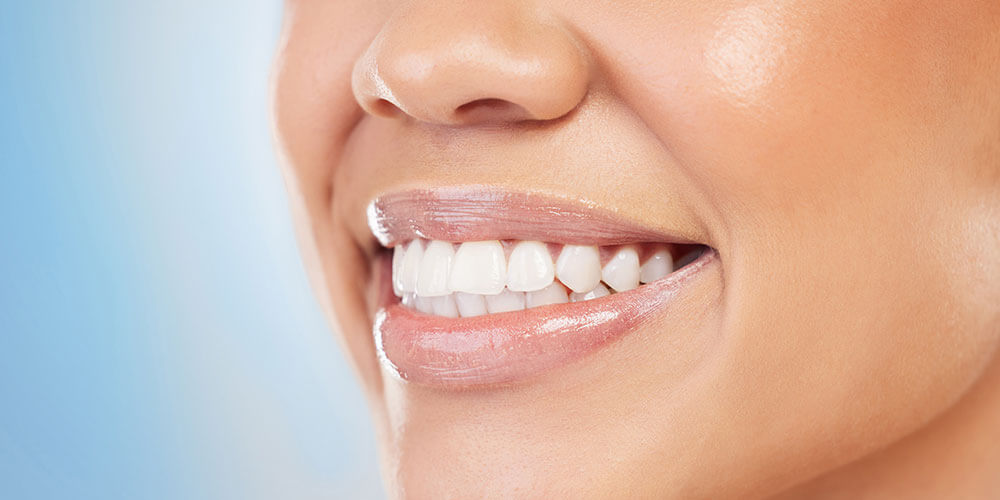 Fluoride Treatment London